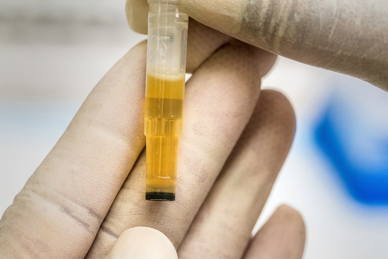Urine verraadt je ware leeftijd